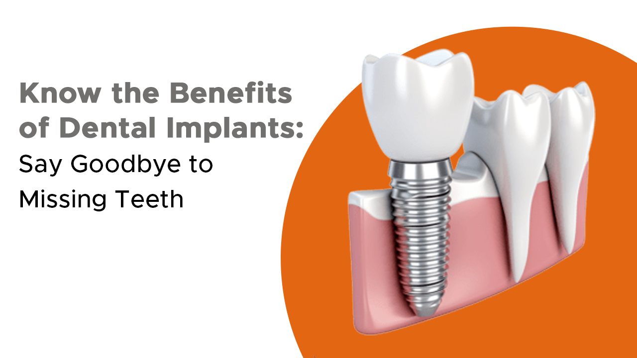Know the Benefits of Dental Implants: Say Goodbye to Missing Teeth