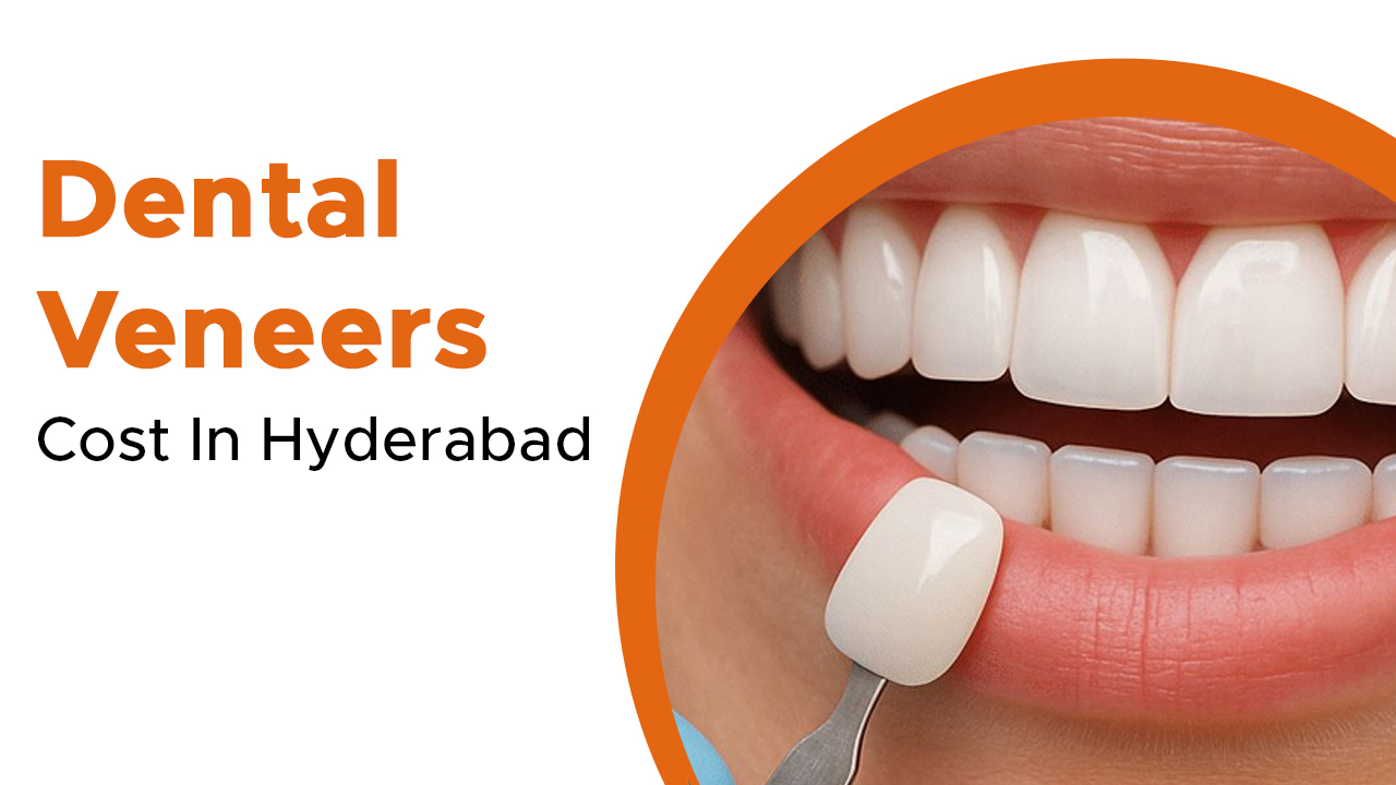 Dental Veneers Cost in Hyderabad