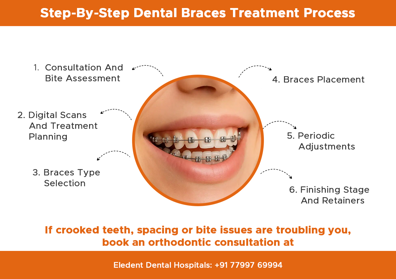 step-by-step-dental-braces-treatment-Process-_info