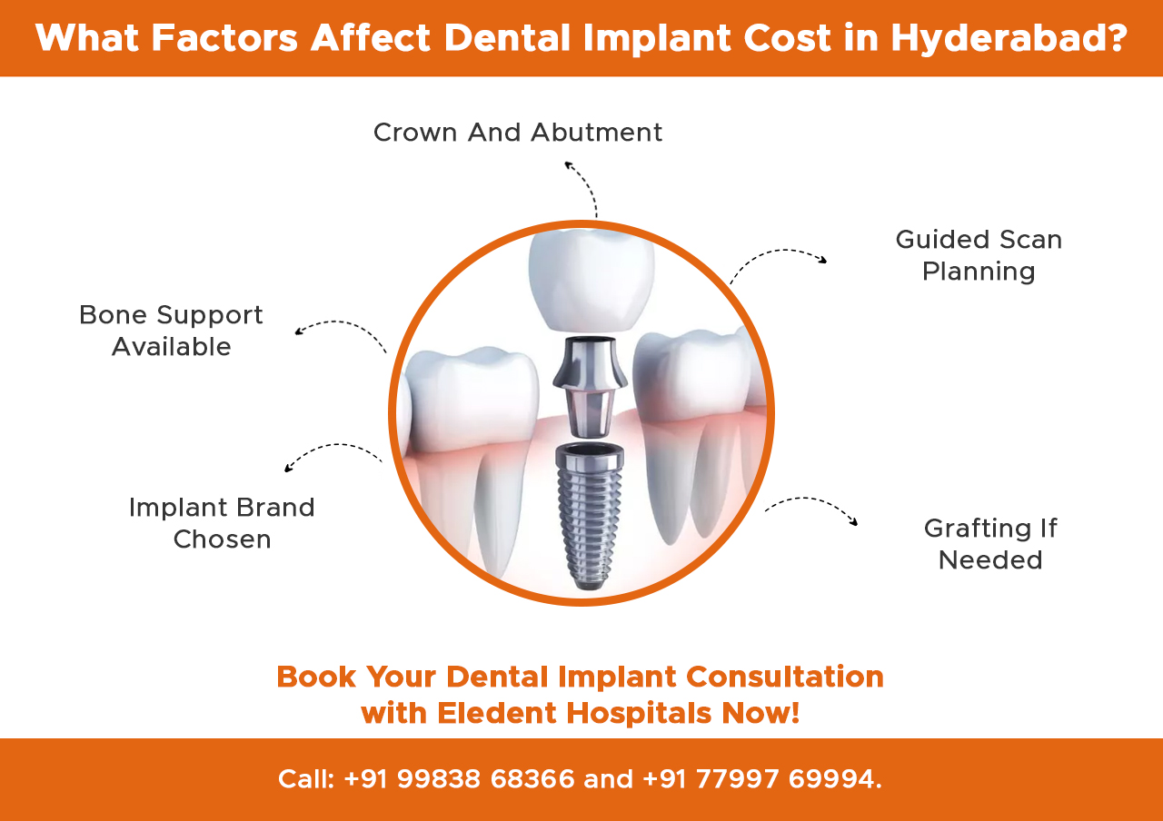 what-factors-affect-dental-implant-cost-in-hyderabad